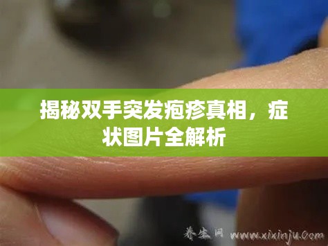 揭秘双手突发疱疹真相，症状图片全解析